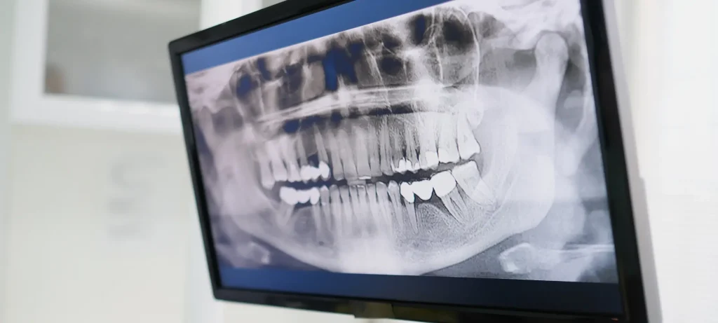 الذكاء الاصطناعي في طب الأسنان